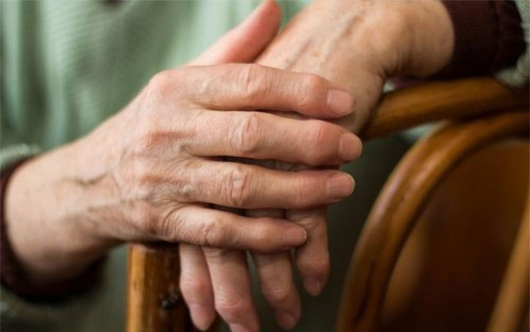 Viêm khớp dạng thấp là bệnh lý tự miễn thường ảnh hưởng đến các khớp nhỏ, chẳng hạn như khớp ngón tay