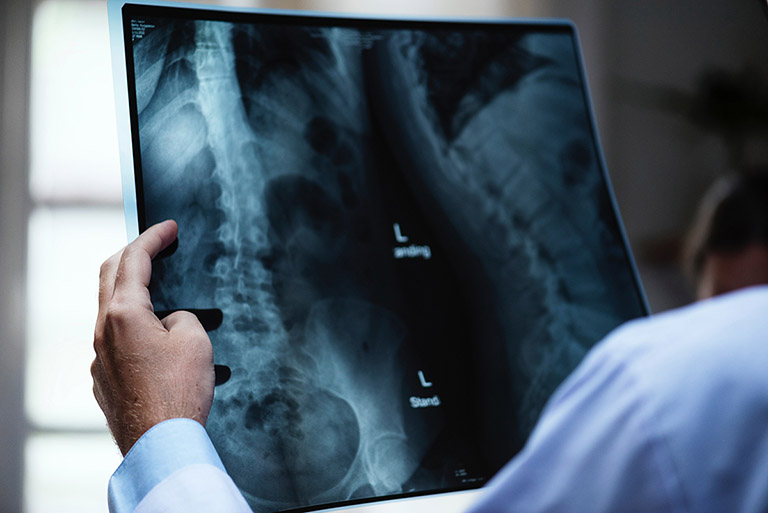 Bệnh nhân cần chụp X-quang để kiểm tra mật độ xương