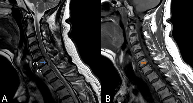 Chụp cộng hưởng từ (MRI) cung cấp hình ảnh chi tiết ở vùng cổ