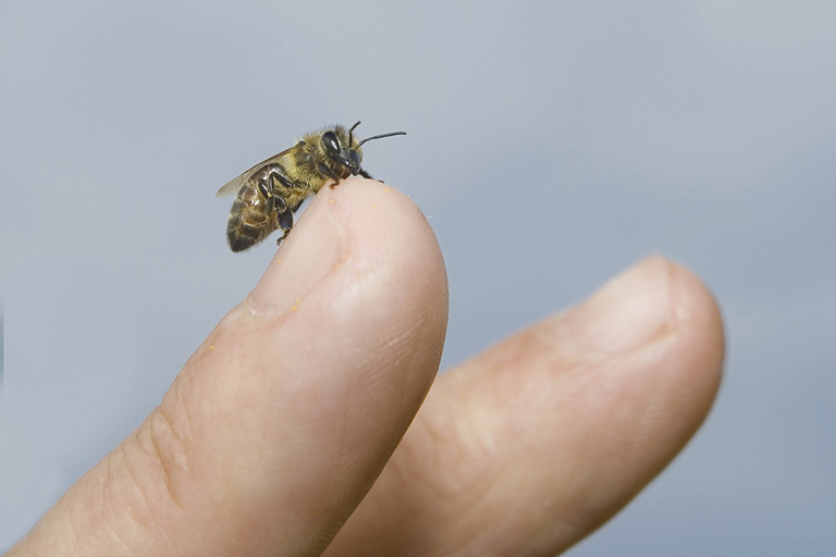 Chữa viêm khớp dạng thấp bằng nọc ong được không?