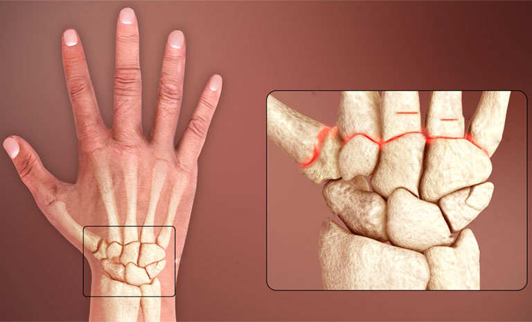  Cổ tay: Cấu tạo xương, khớp và thông tin cần biết