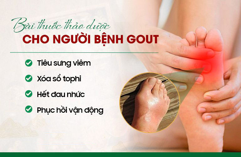 Bài thuốc thảo dược đặc trị bệnh Gout hiệu quả và an toàn nhất