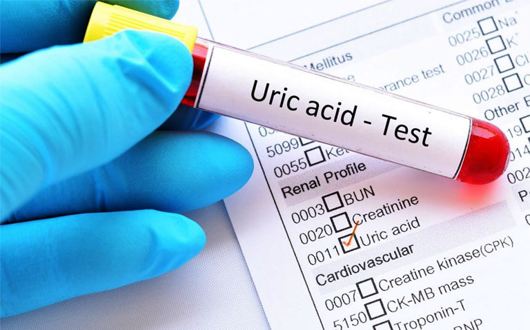 chỉ số acid uric trong xét nghiệm máu