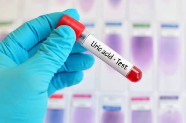 Điều trị hạ axit uric máu bằng bài thuốc Y học cổ truyền