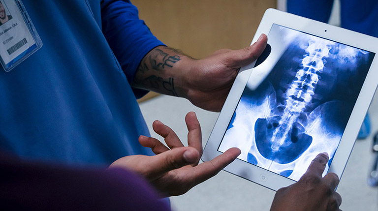 Chụp X-quang được chỉ định với mục đích phát hiện gai xương trong cột sống