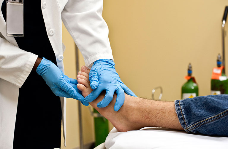 tiêu chuẩn chẩn đoán tràn dịch khớp cổ chân