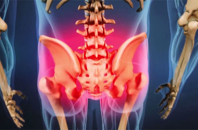 Bị đau lưng dưới gần mông ở nam giới