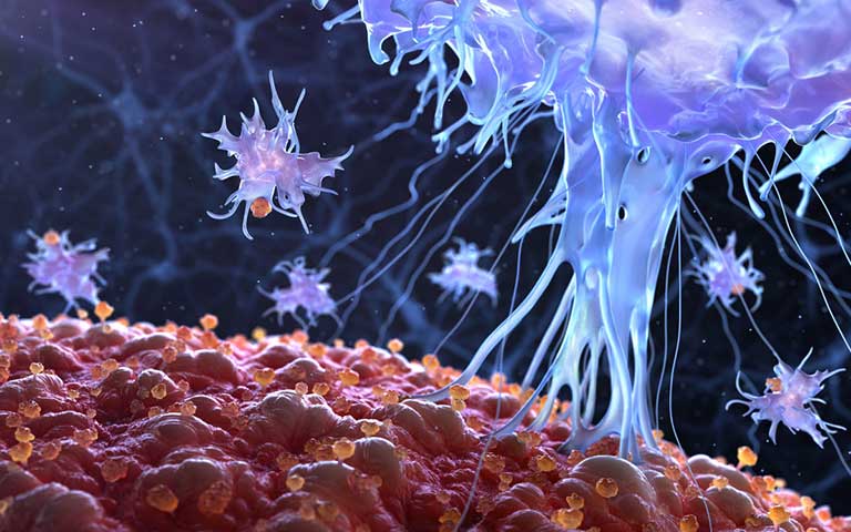Chữa lupus ban đỏ bằng tế bào gốc