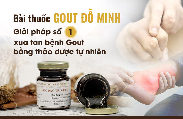 Bài thuốc Gout Đỗ Minh giải pháp điều trị dứt điểm bệnh gút, không tái phát