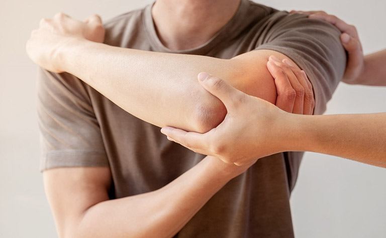 Viêm khớp khuỷu tay do bệnh gout 