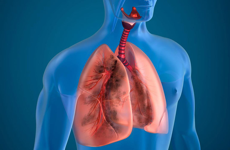 Bệnh lý ở phổi