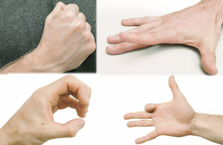 Bài tập trị đau khớp ngón tay mãn tính