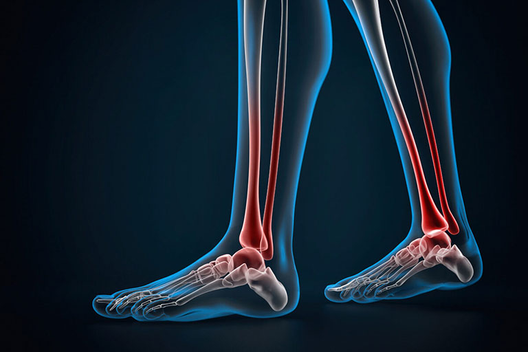 Bài tập chữa đau gót chân