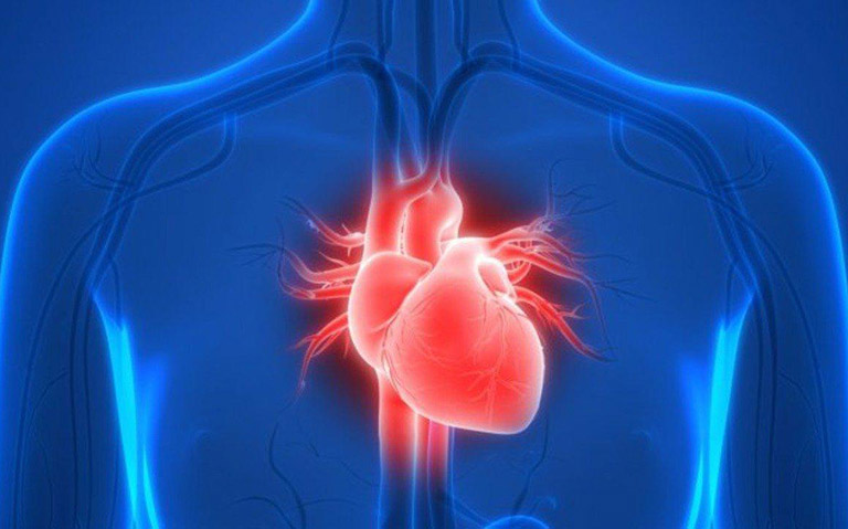 Đau nhói giữa ức liên quan đến một cơn đau tim
