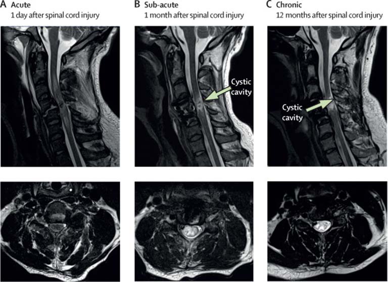 Chụp cộng hưởng từ (MRI)
