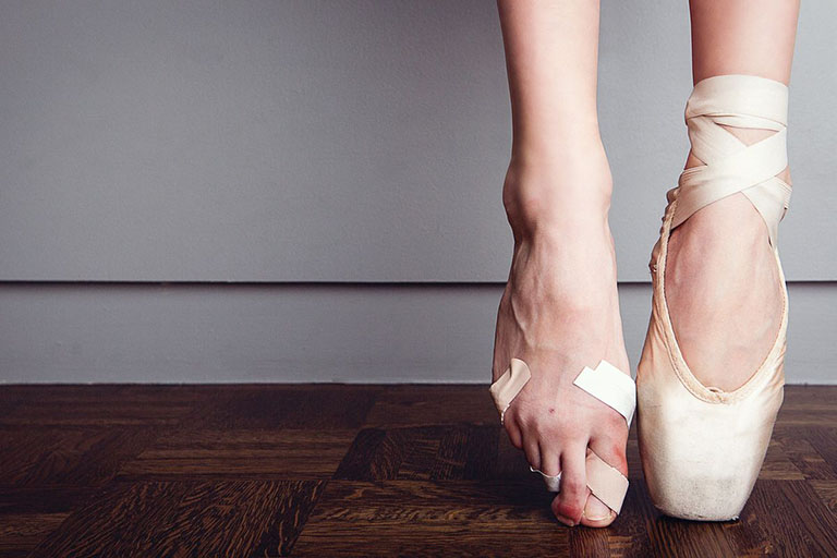 Vũ công múa ballet có nguy cơ cao bị gãy xương ngón chân và bàn chân