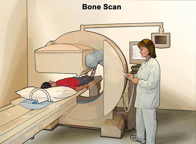 Quét xương được thực hiện sau khi chất phóng xạ lưu thông và được xương hấp thụ