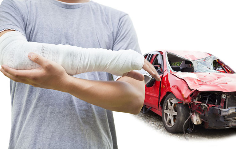 tai nạn xe gây gãy xương hở