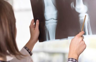 Chẩn đoán hình ảnh bệnh xương khớp chính xác có vai trò quan trọng trong điều trị