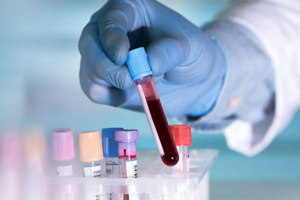 Xét nghiệm huyết học xác định nguy cơ mất máu khi bị chấn thương
